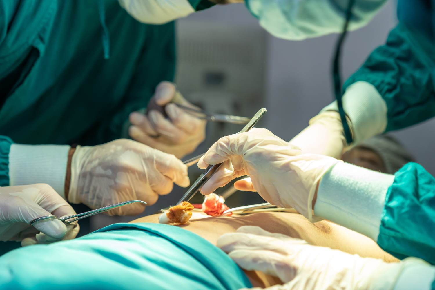 Endoscopy treatment