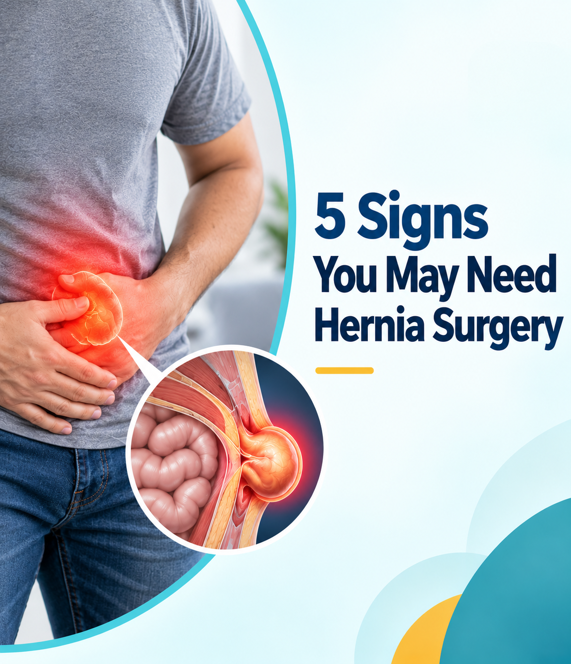 5 Clear Signs You May Need Hernia Surgery | Solo Clinic GI