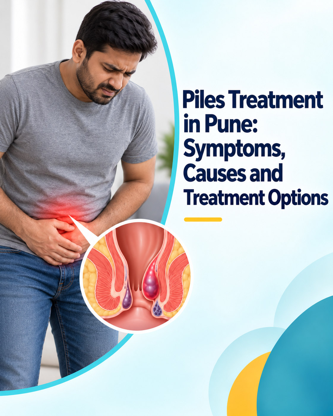 Piles Treatment in Pune at Solo Clinic GI